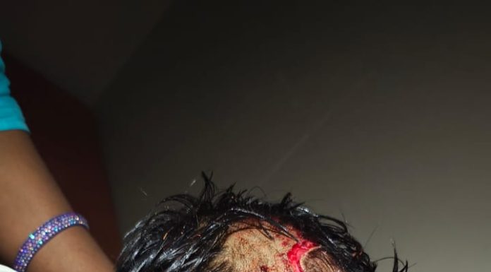 Devgad: मालपे येथे आठ वर्षाच्या मुलावर भटक्या कुत्र्यांचा हल्ला, मुलगा गंभीर