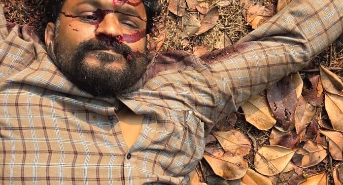कणकवलीत बांधकाम व्यावसायिकाचा संशयास्पद मृत्यू; डोक्यावर गंभीर इजा