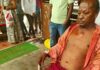 Lanja Breaking : एसटी बस आणि रिक्षा यांच्यात अपघात, दोघे जखमी