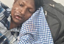 Breaking News : राजापूरमध्ये ग्राइंडरचे ब्लेड तुटून युट्यूबर गंभीर जखमी!